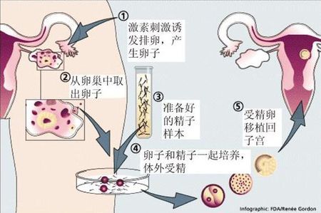 Fig.01